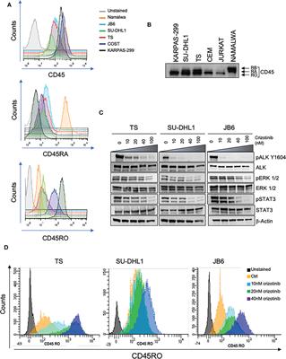 Regulation of CD45 phosphatase by oncogenic ALK in anaplastic large cell lymphoma